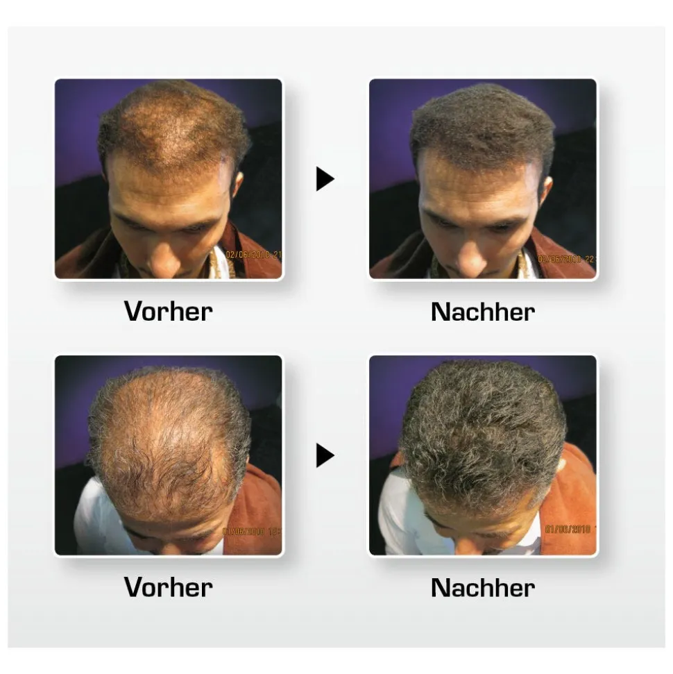 BioThik Haaraufbau-Faser S1 schwarz 25 g