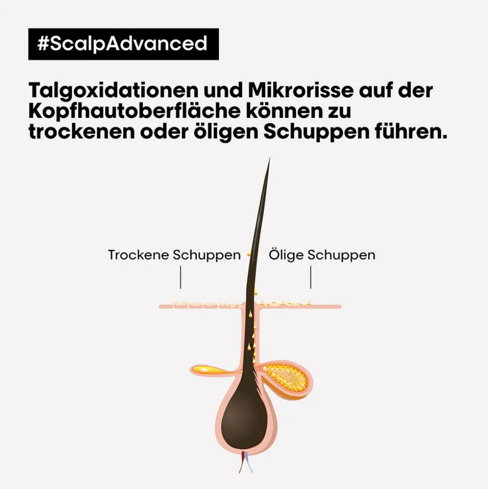 L'Oréal Professionnel Paris Série Expert Scalp Advanced Anti-Dandruff Dermo-Clarifier Shampoo 300 ml