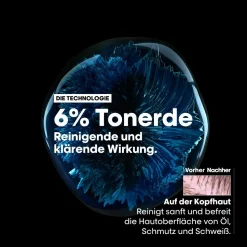 L'Oréal Professionnel Paris Série Expert Scalp Advanced Anti-Oiliness Dermo-Purifier Shampoo 300 ml